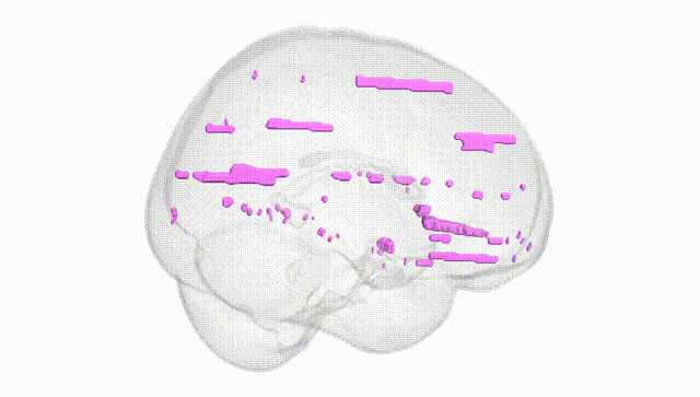 Full Brain White