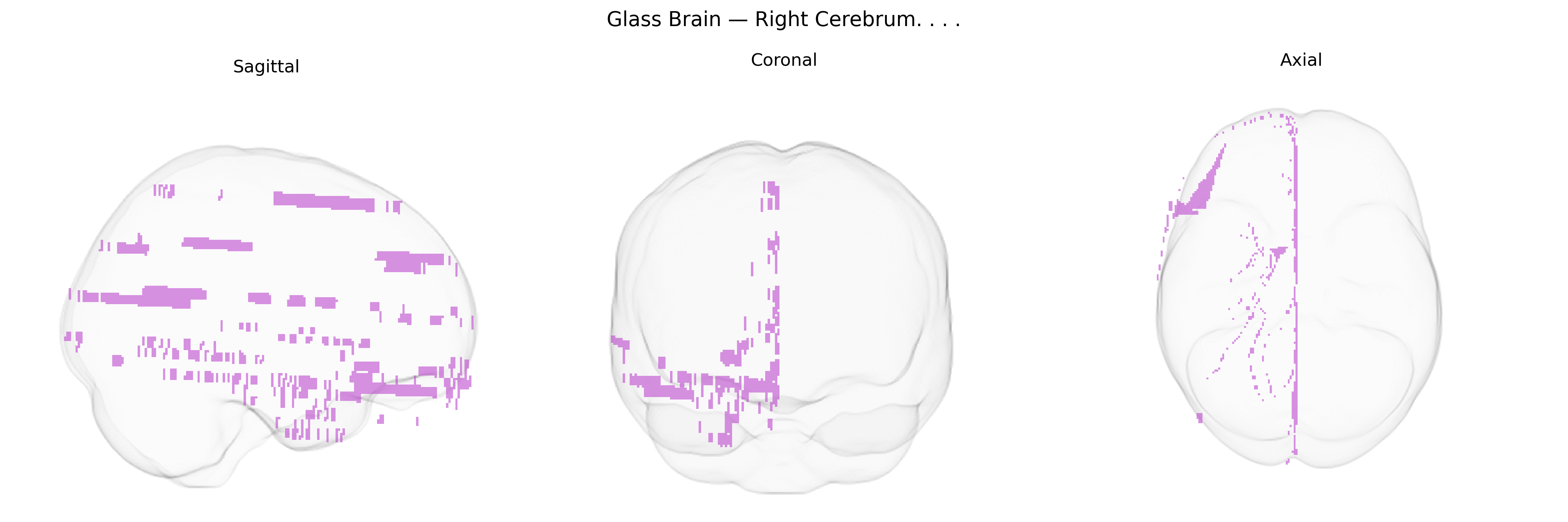 Triplanar Ghost Brain