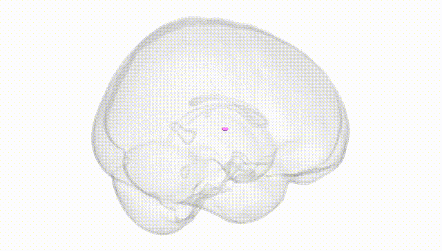 Full Brain White