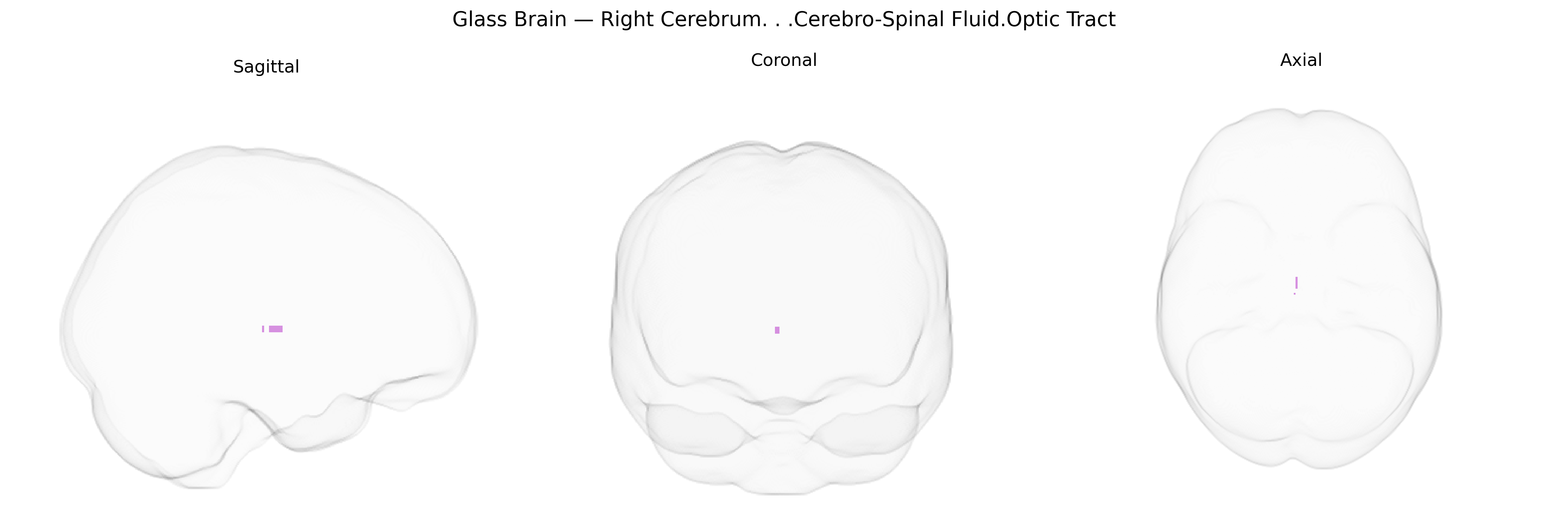 Triplanar Ghost Brain