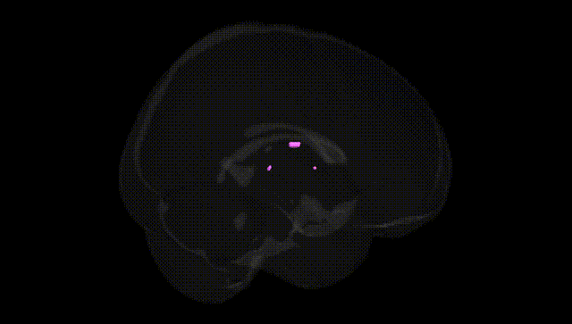 Full Brain Black