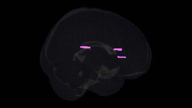 Full Brain Black