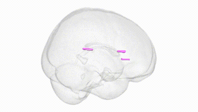 Full Brain White