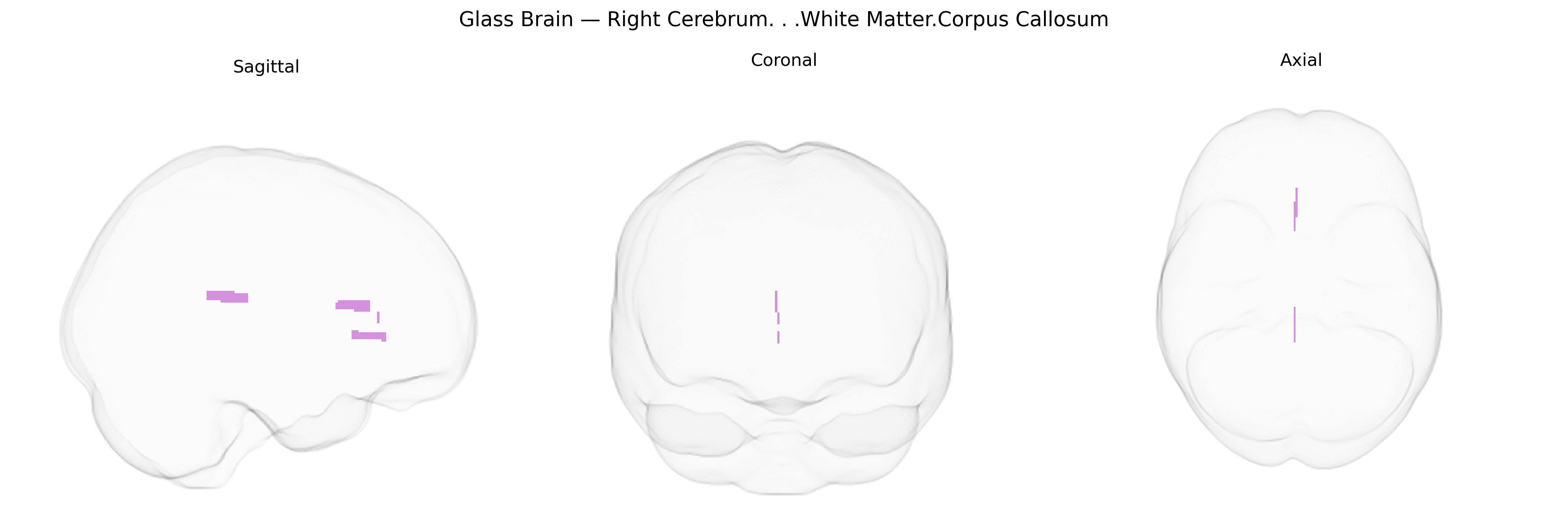 Triplanar Ghost Brain