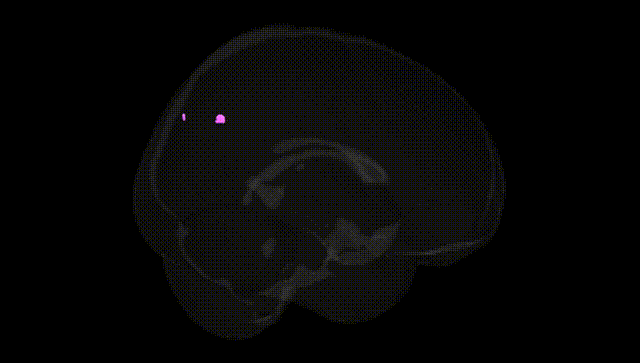 Full Brain Black
