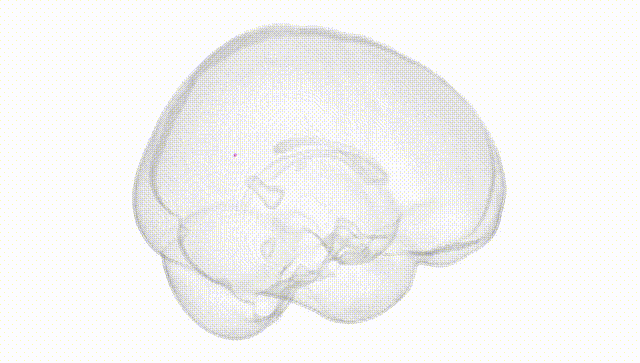 Full Brain White