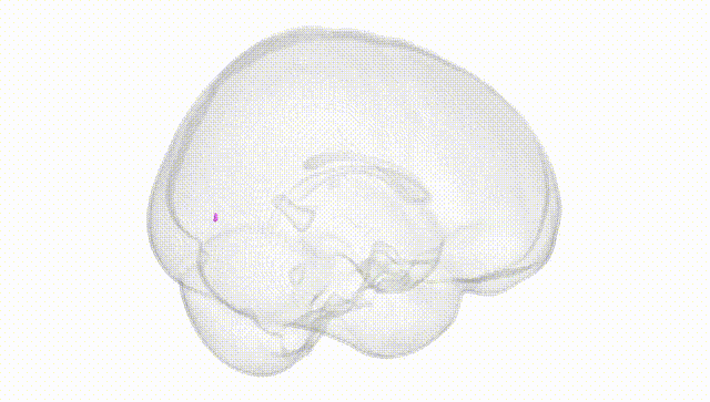 Full Brain White