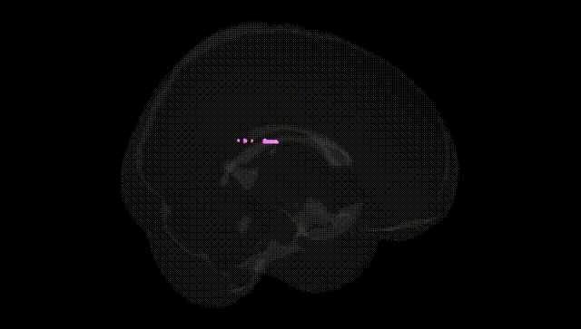 Full Brain Black