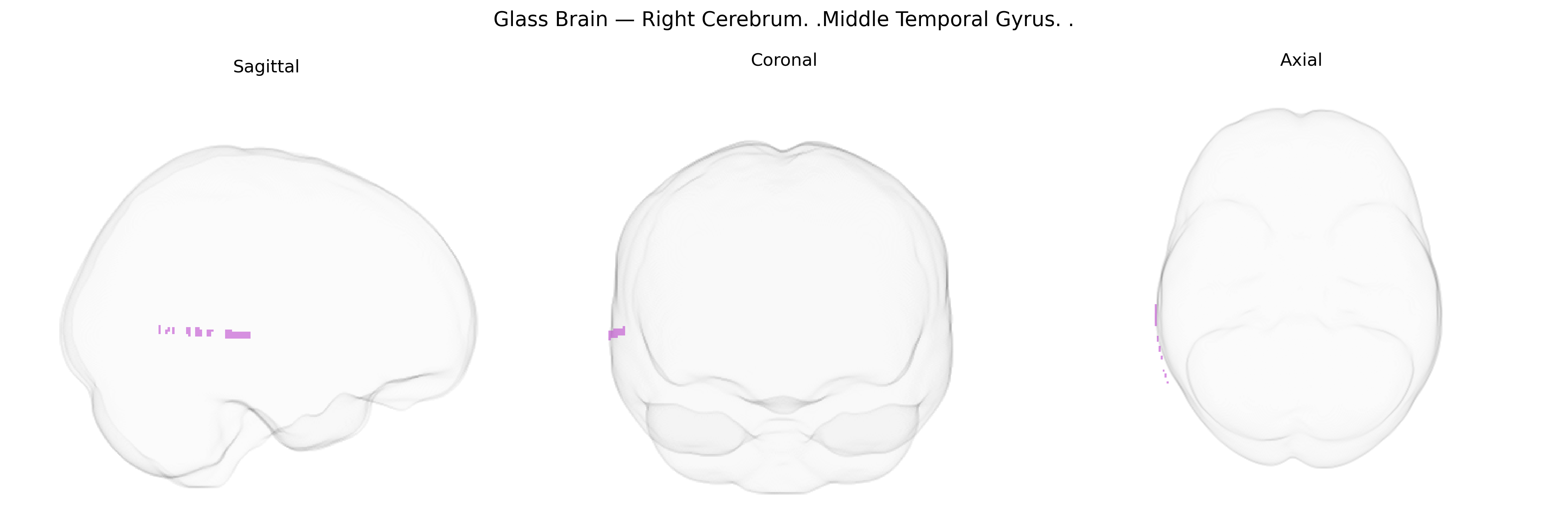 Triplanar Ghost Brain