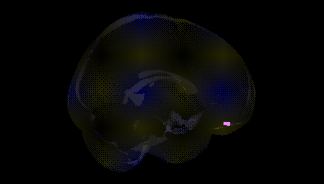 Full Brain Black