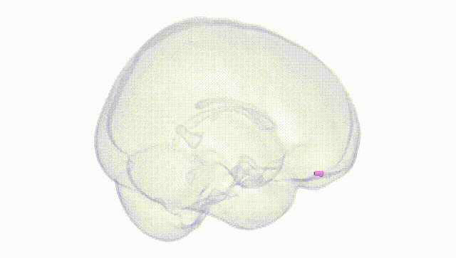 Full Brain White