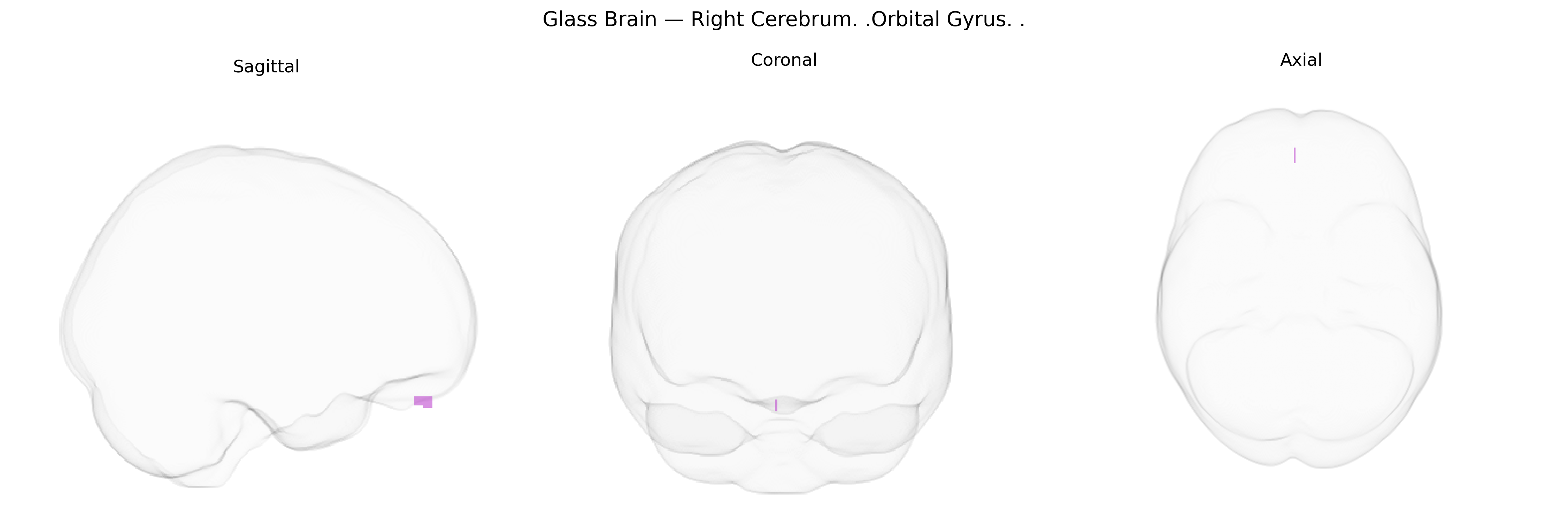 Triplanar Ghost Brain