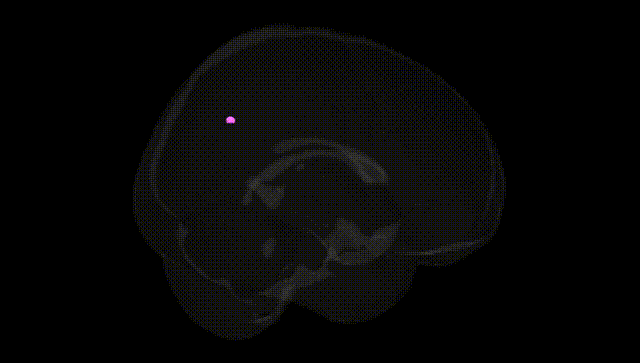 Full Brain Black