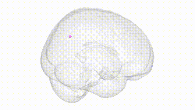 Full Brain White