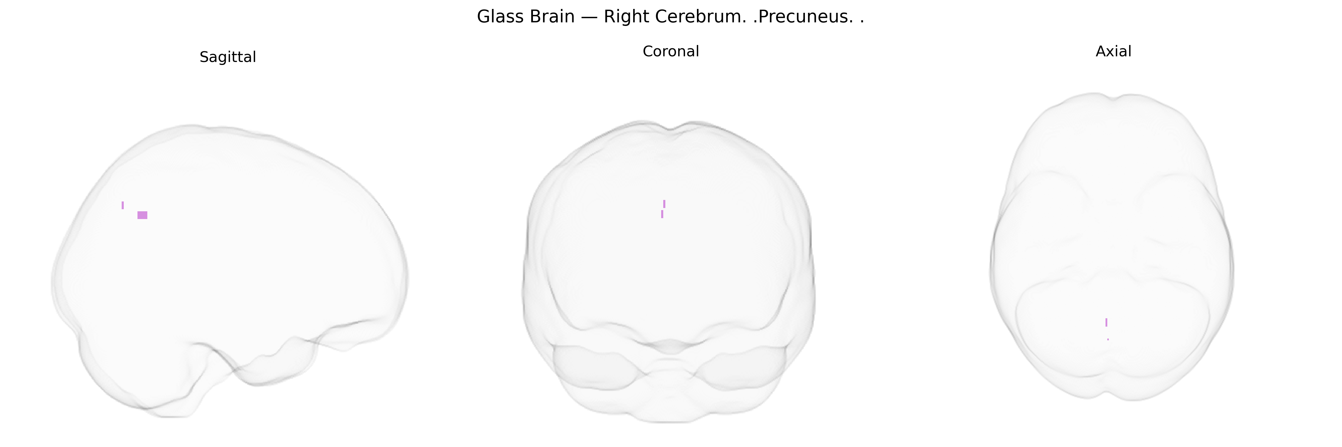 Triplanar Ghost Brain