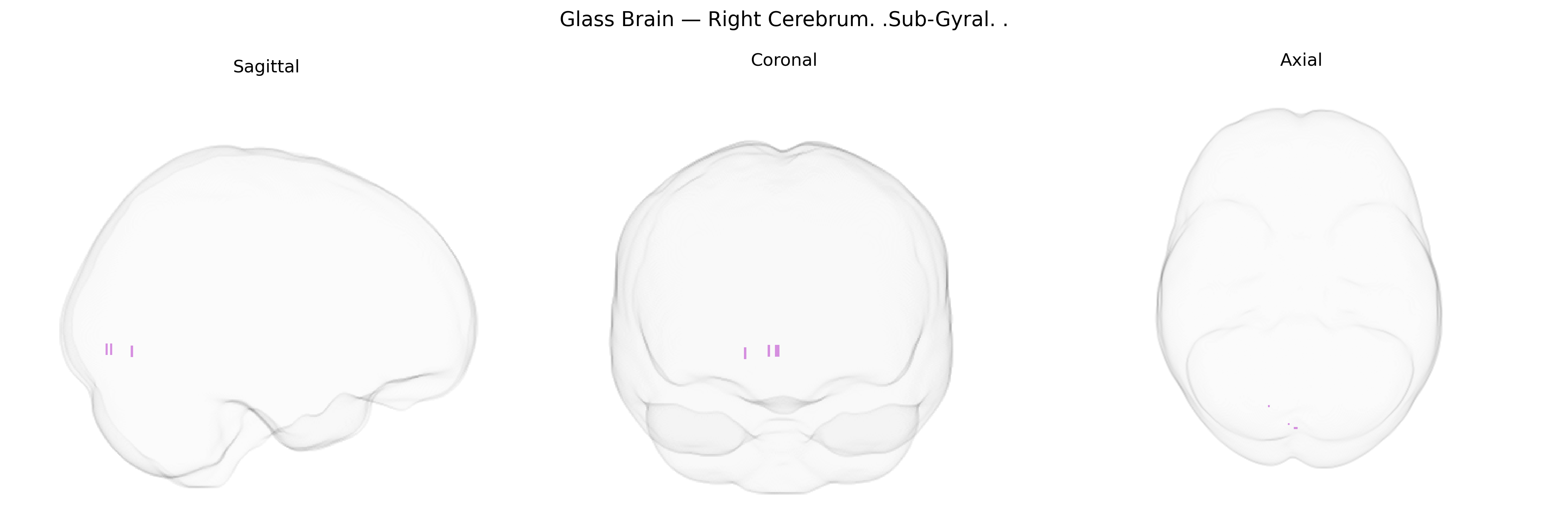 Triplanar Ghost Brain