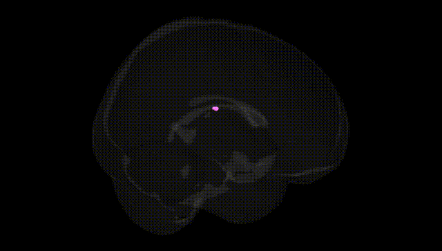 Full Brain Black