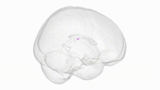Full Brain White