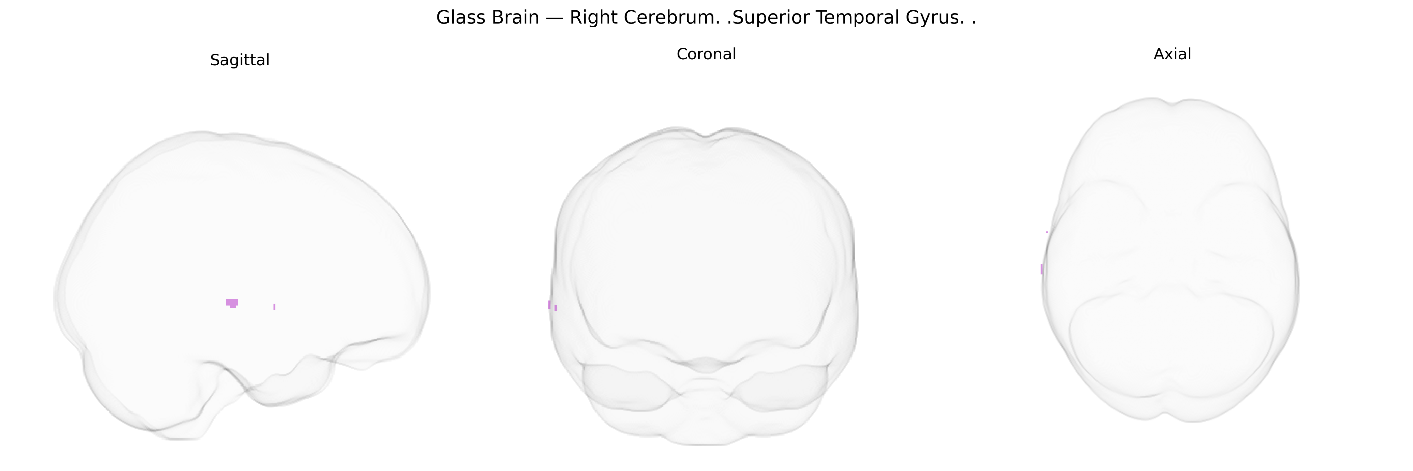 Triplanar Ghost Brain