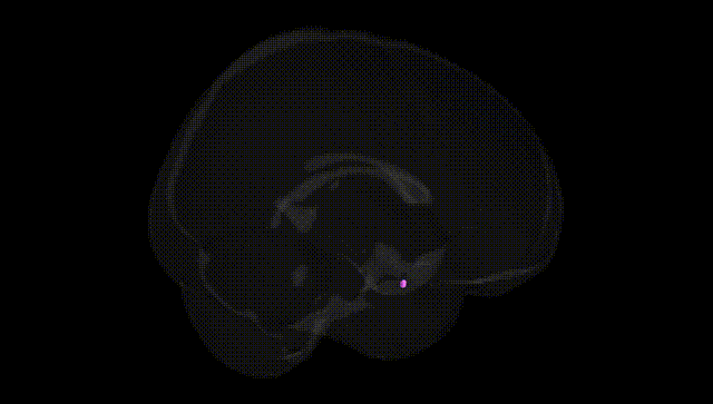 Full Brain Black