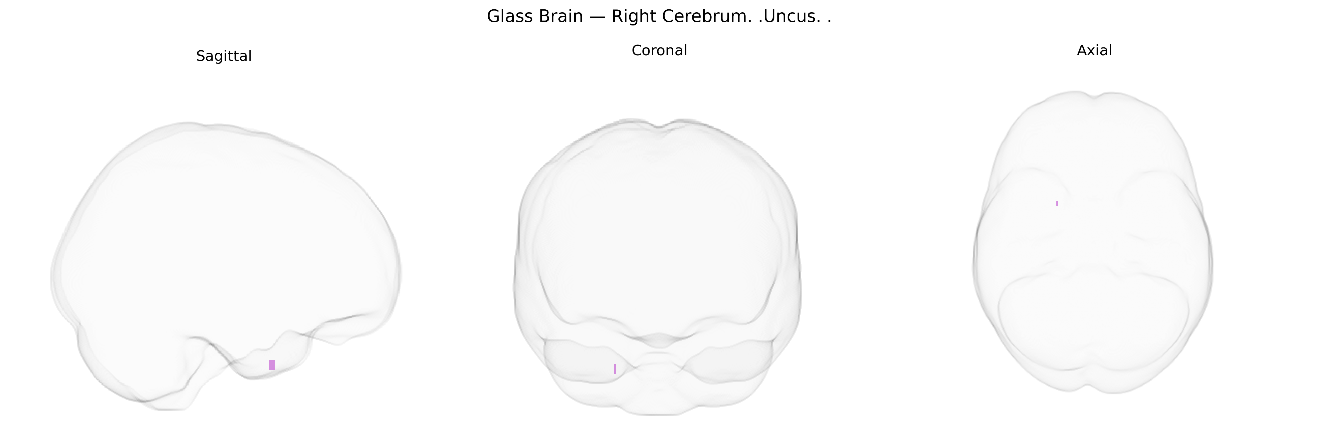 Triplanar Ghost Brain