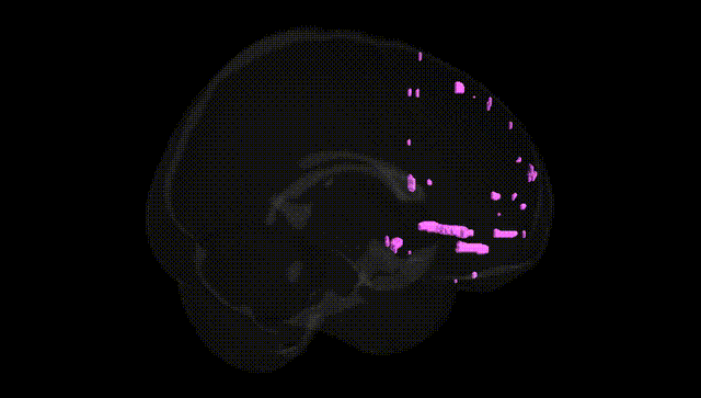 Full Brain Black