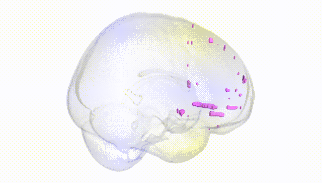 Full Brain White