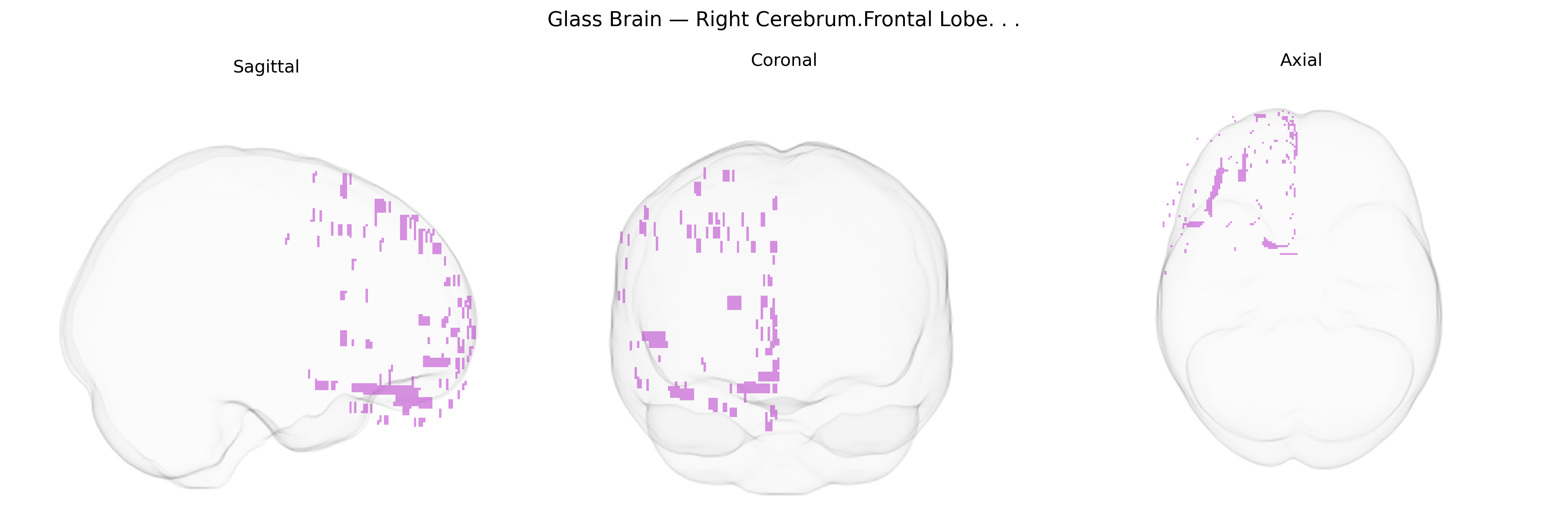 Triplanar Ghost Brain