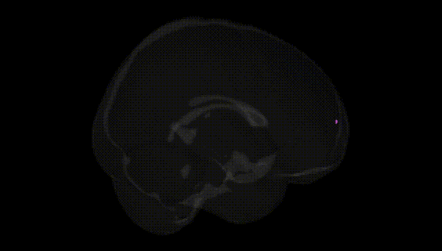 Full Brain Black