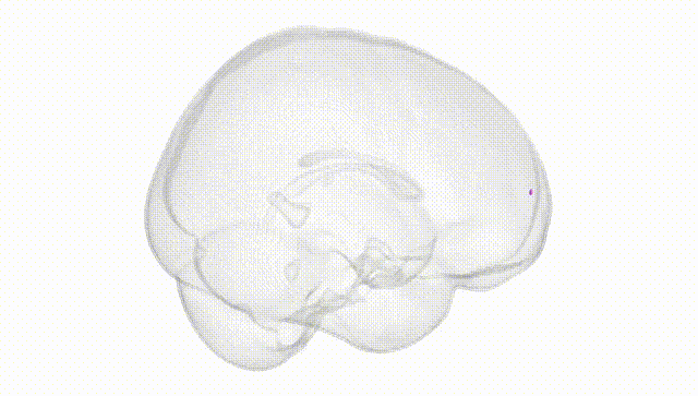 Full Brain White