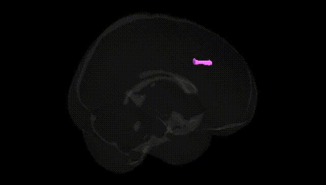 Full Brain Black