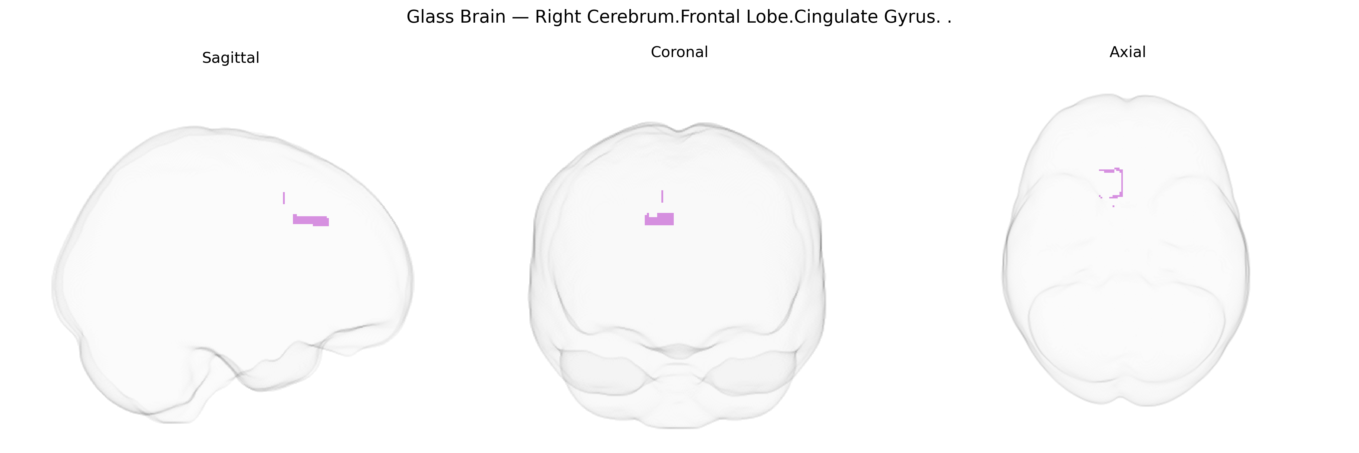 Triplanar Ghost Brain