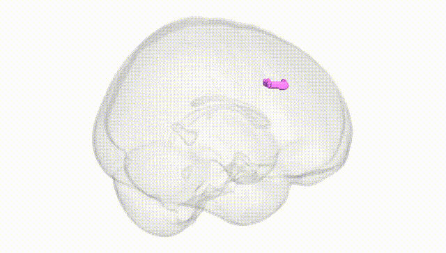Full Brain White