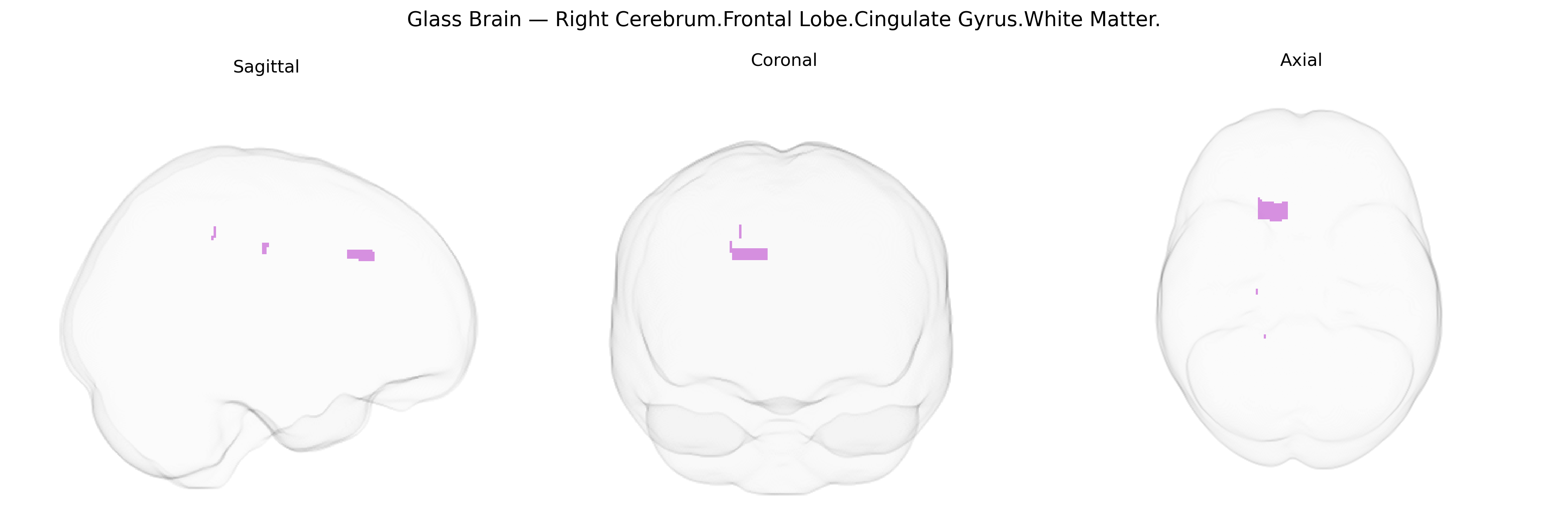 Triplanar Ghost Brain
