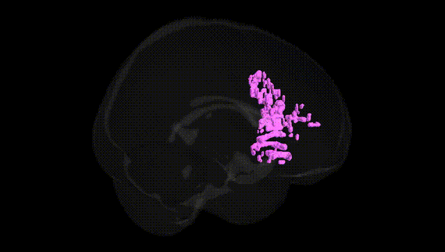 Full Brain Black