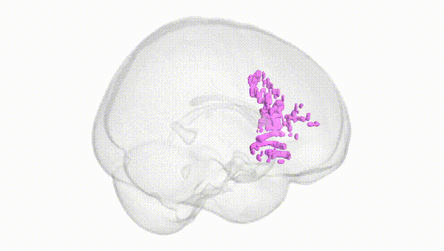 Full Brain White