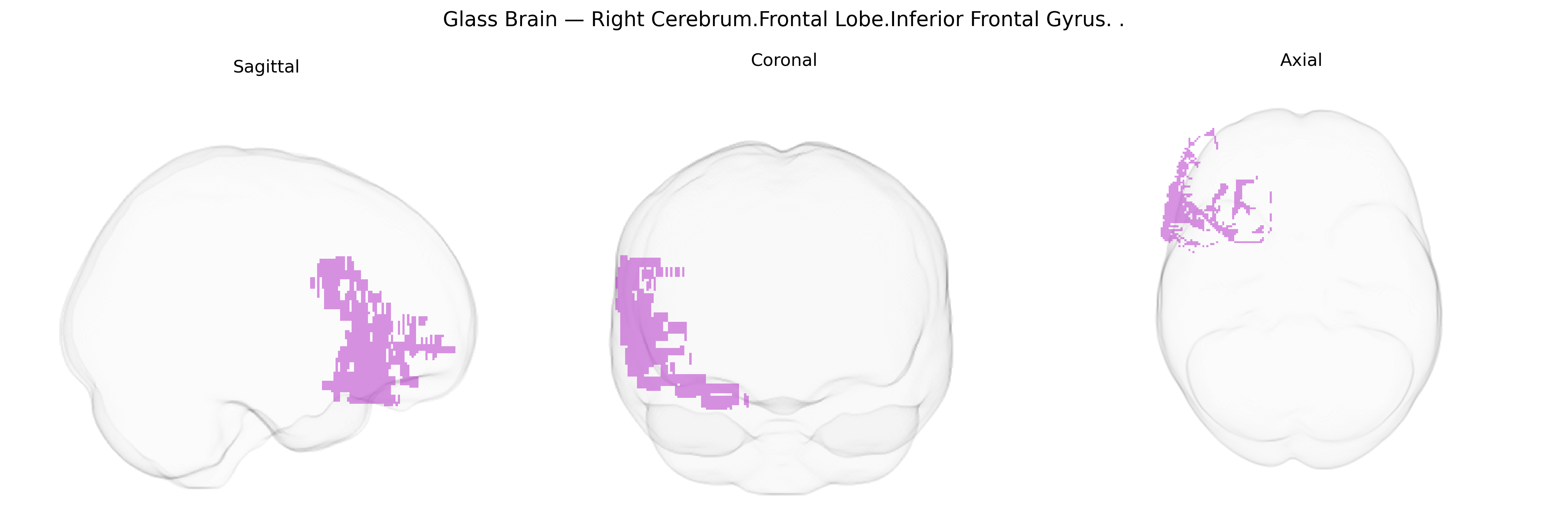 Triplanar Ghost Brain