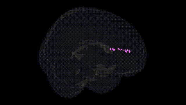 Full Brain Black