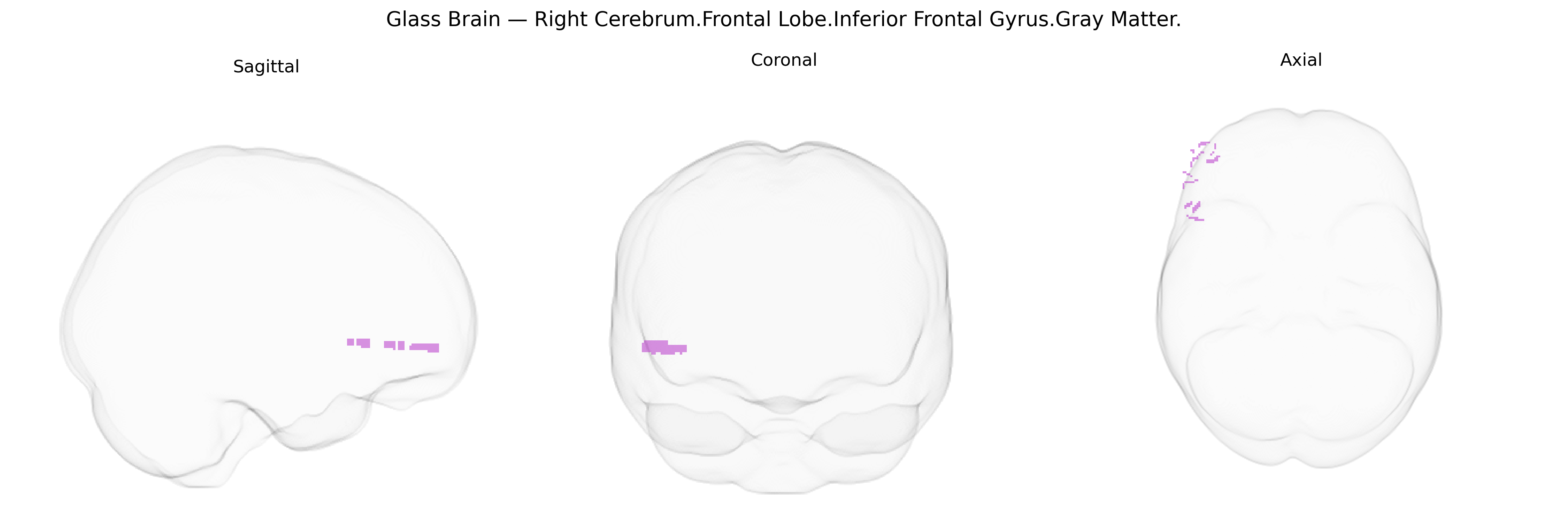 Triplanar Ghost Brain