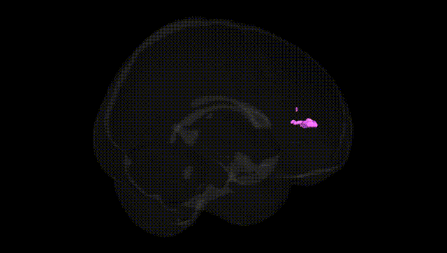 Full Brain Black
