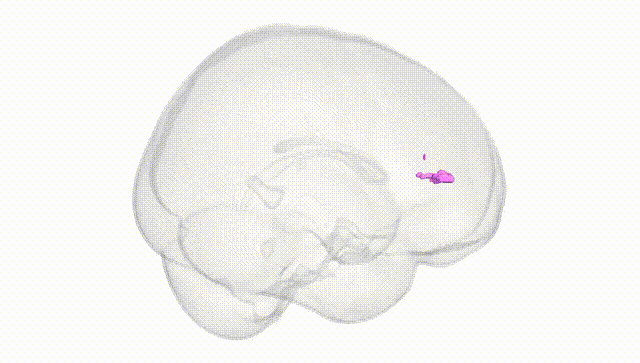 Full Brain White