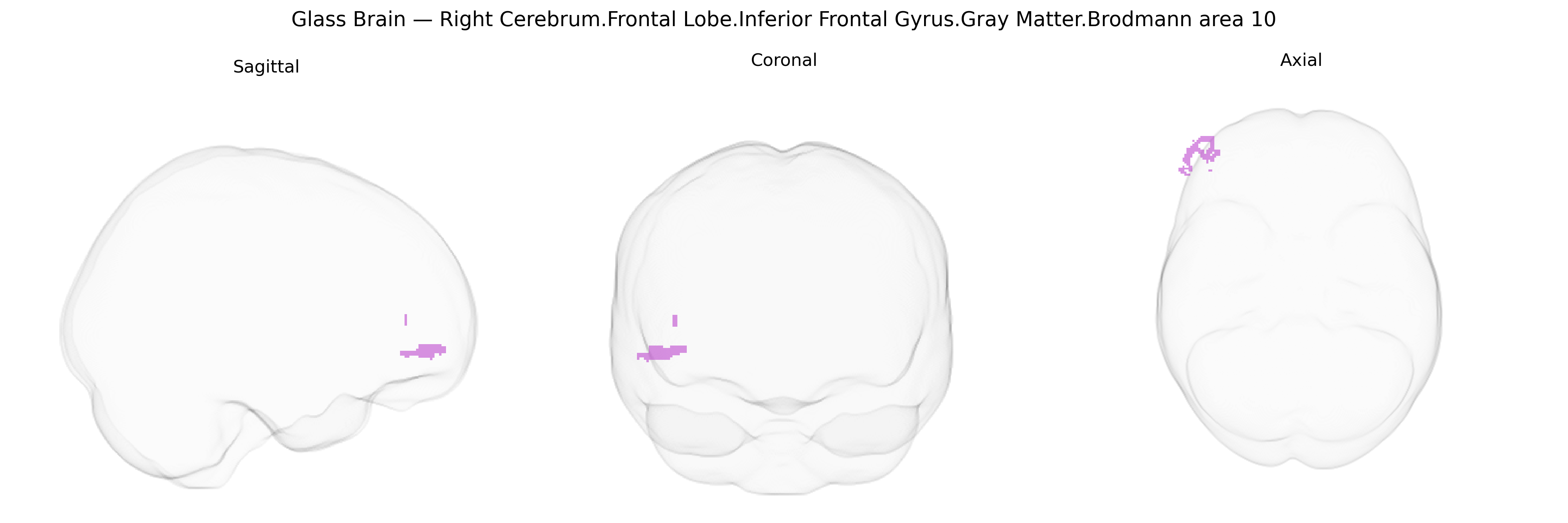Triplanar Ghost Brain