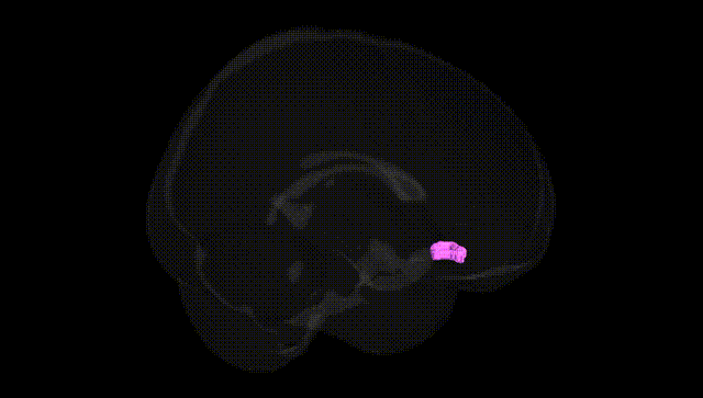 Full Brain Black