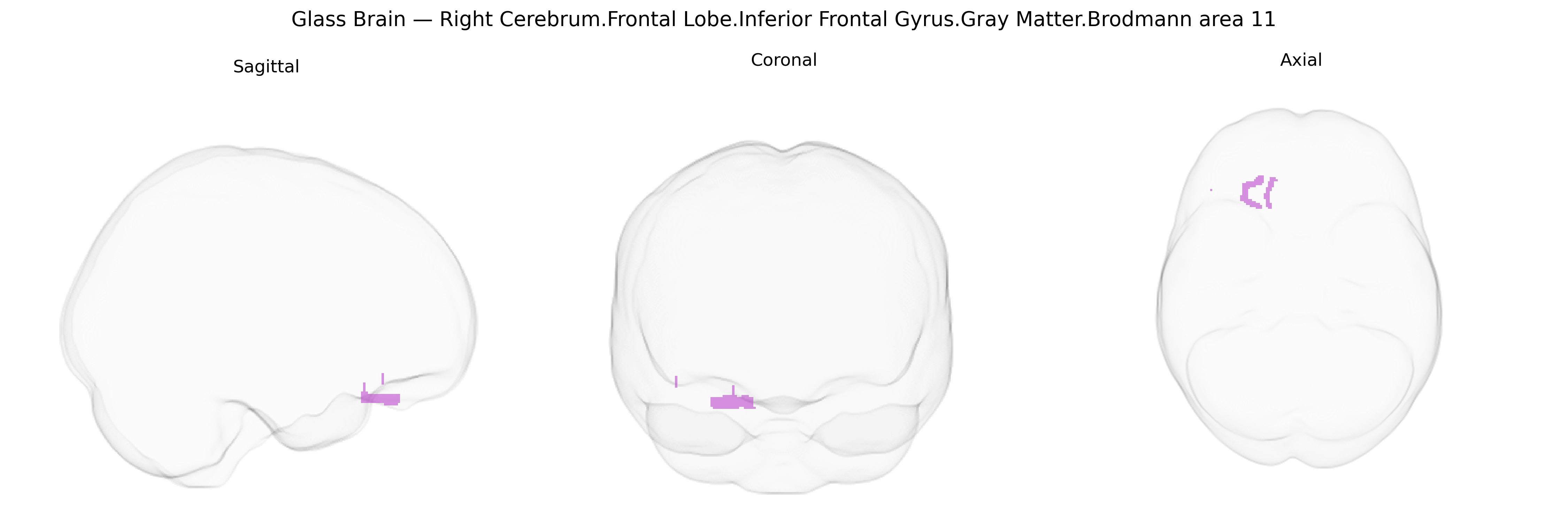 Triplanar Ghost Brain
