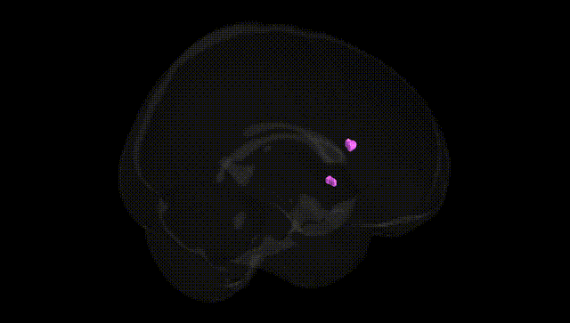 Full Brain Black