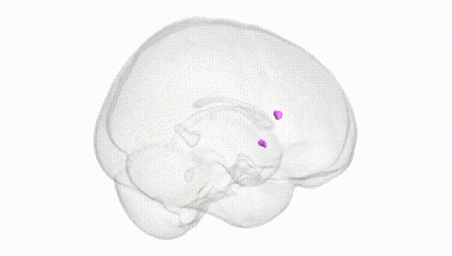 Full Brain White