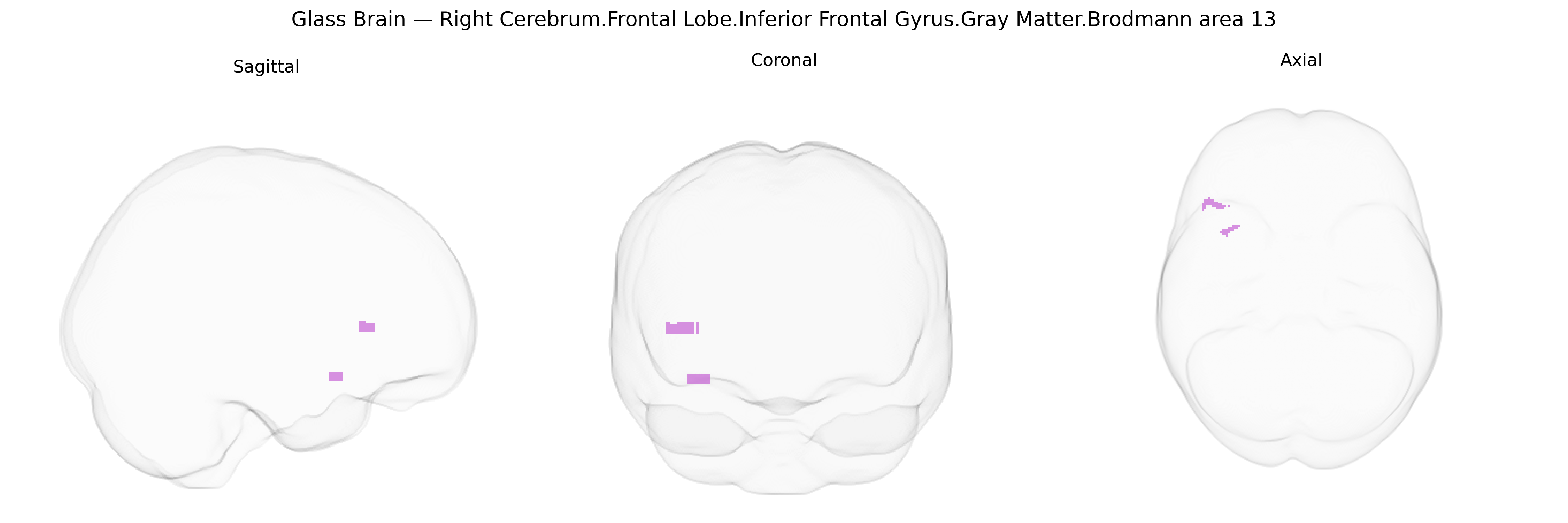 Triplanar Ghost Brain