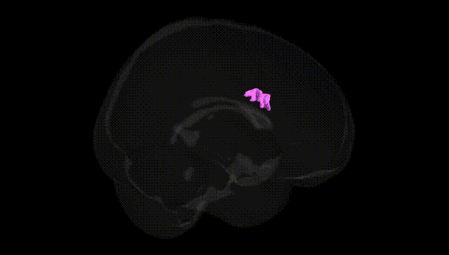 Full Brain Black