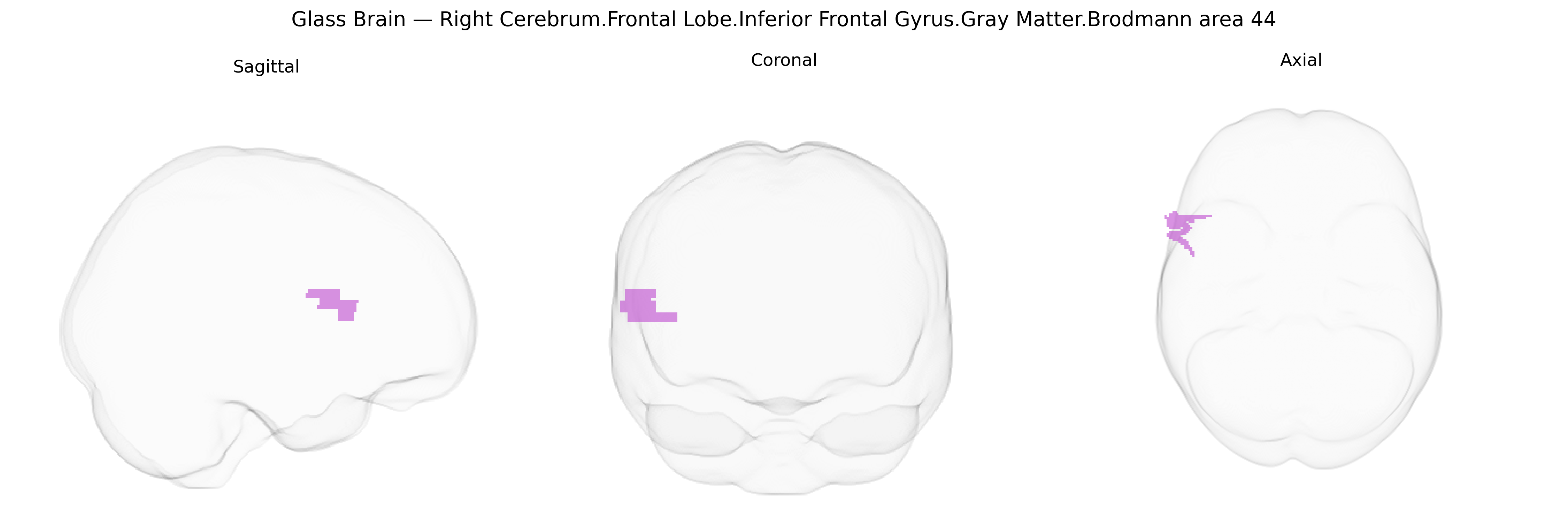 Triplanar Ghost Brain