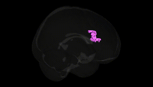Full Brain Black